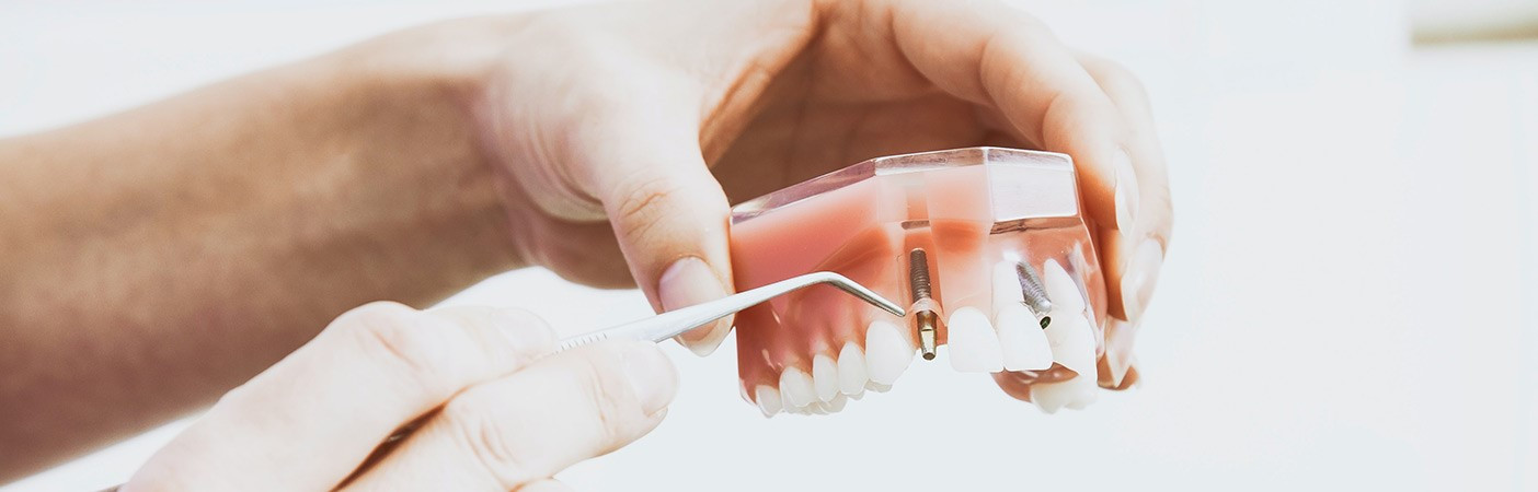 chirurgia-orale-per-il-benessere-della-tua-bocca
