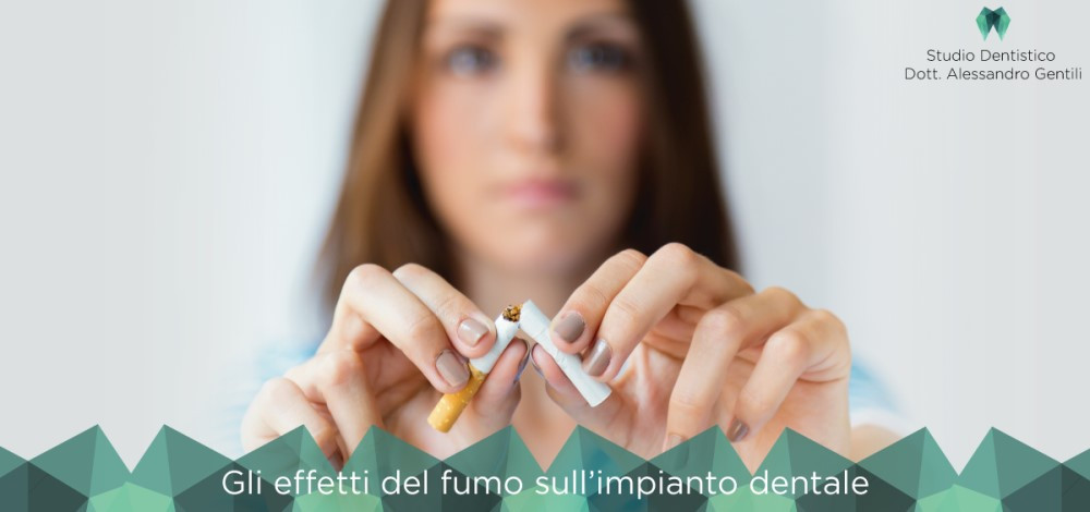 Gli effetti del fumo sull’impianto dentale