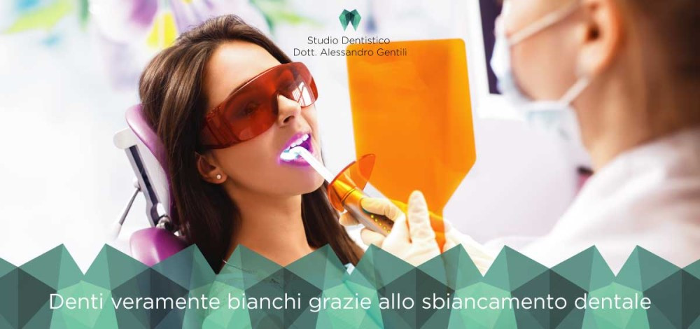 Denti veramente bianchi?