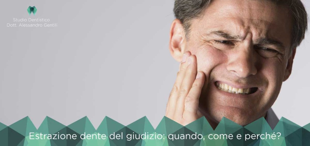Estrazione dente del giudizio