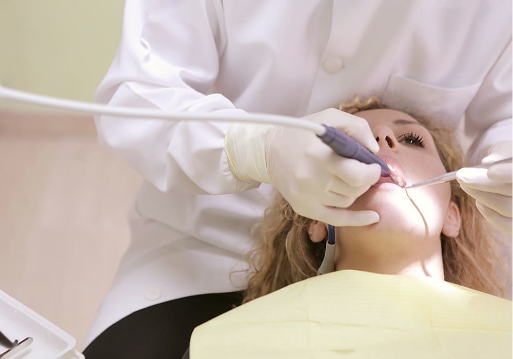 Faccette dentali: come prendersene cura