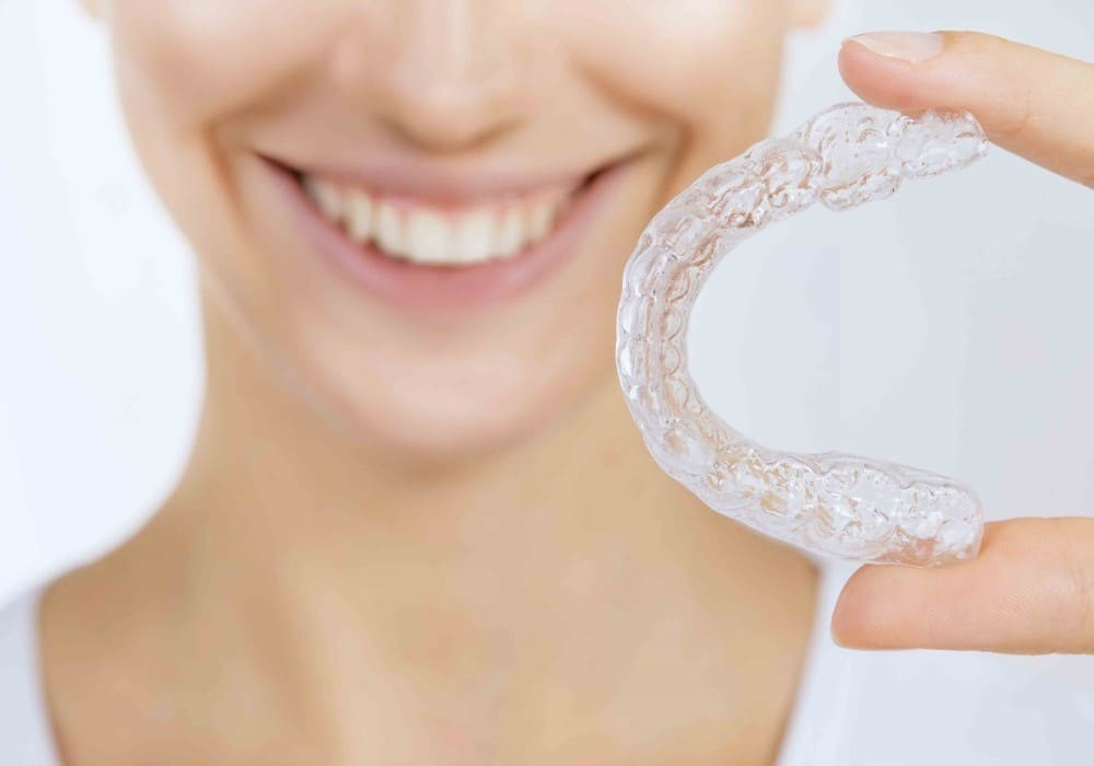 Apparecchio denti Invisalign