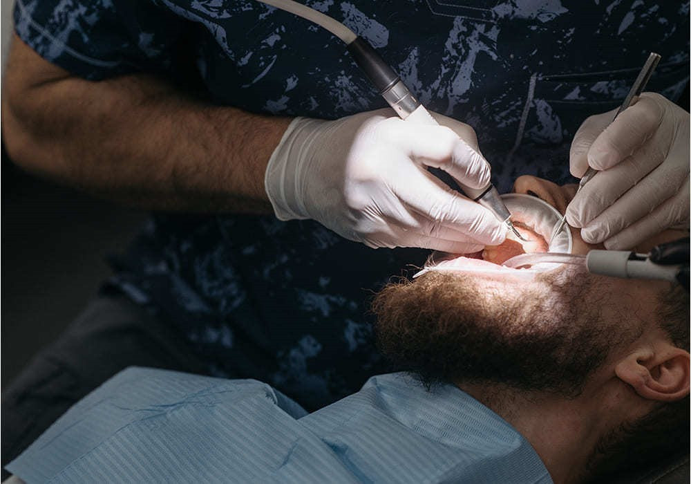 Devitalizzazione dei denti