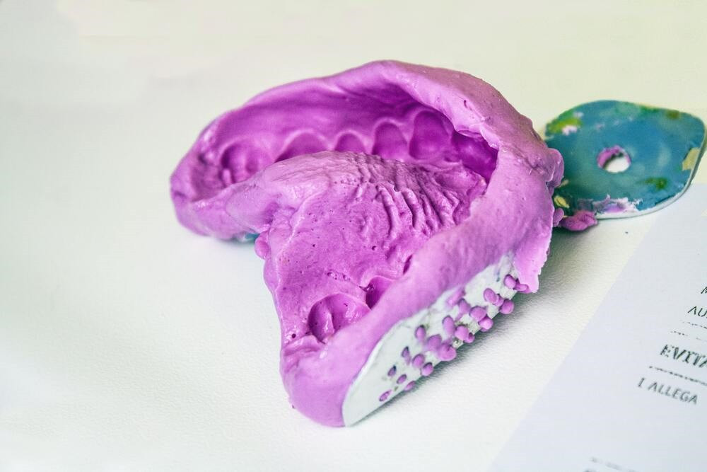 Bite dentale: cos’è e a cosa serve