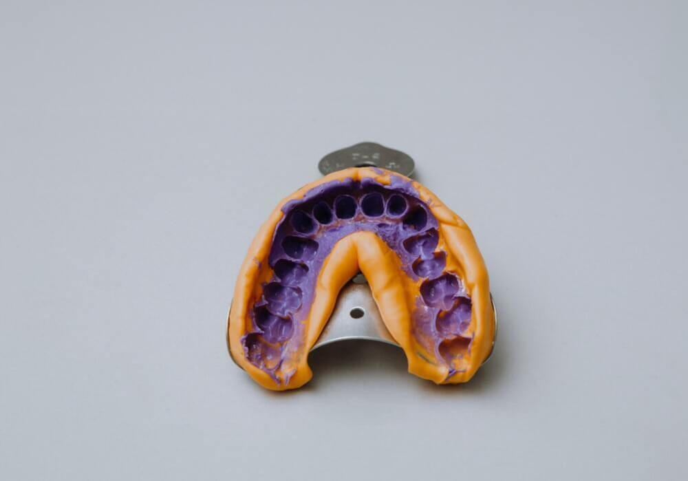Ponte o un impianto dentale?