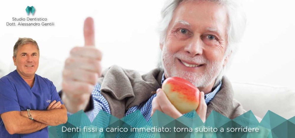 Denti fissi a carico immediato